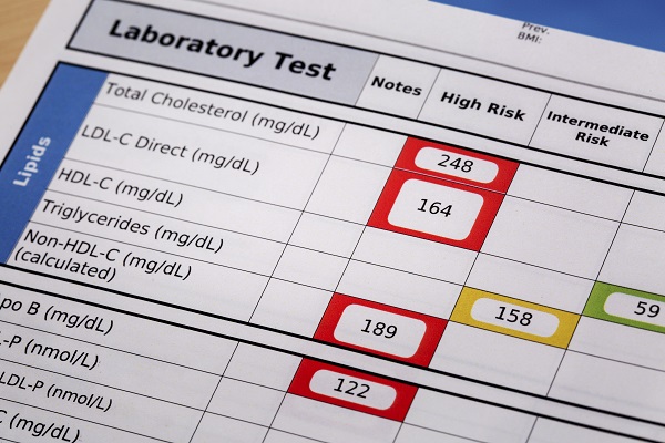 Form showing test results